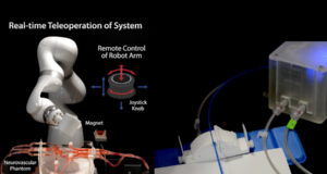Νέο τηλερομποτικό σύστημα του ΜΙΤ βοηθά τους νευροχειρουργούς να αντιμετωπίσουν τα εγκεφαλικά εξ αποστάσεως