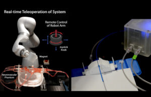 Νέο τηλερομποτικό σύστημα του ΜΙΤ βοηθά τους νευροχειρουργούς να αντιμετωπίσουν τα εγκεφαλικά εξ αποστάσεως