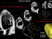 Λογισμικό Ελλήνων επιστημόνων ανιχνεύει καρδιακά προβλήματα