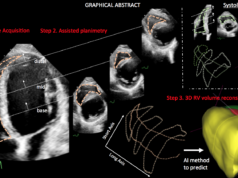Λογισμικό Ελλήνων επιστημόνων ανιχνεύει καρδιακά προβλήματα
