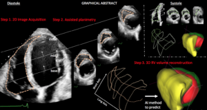 Λογισμικό Ελλήνων επιστημόνων ανιχνεύει καρδιακά προβλήματα