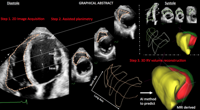 Screen+Shot+software+heart
